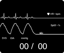 flatline